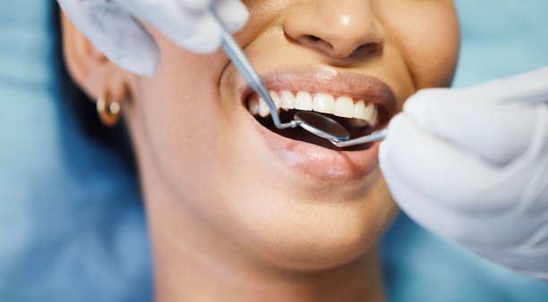 Tooth Infection Emergency Dentist in MO
